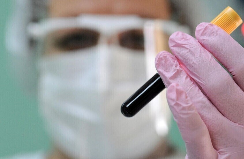 جدل منشأ كوفيد-19 يعود للواجهة.. دراسة تكشف مفاجأة في أصول الأوبئة