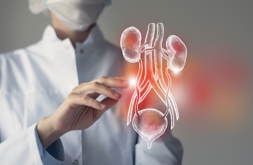 طبيبة تحذر من خطر الإصابة بأمراض الكلى دون ظهور أعراض