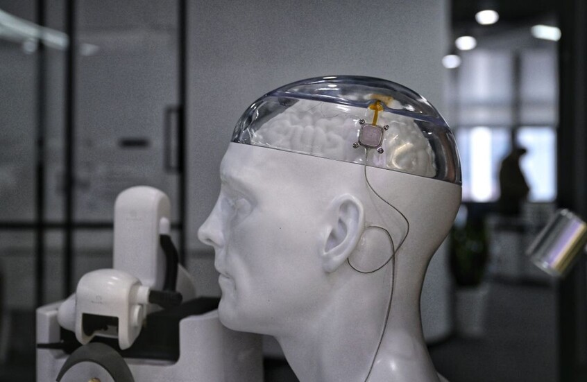 الصين تدخل سباق الرقاقات الدماغية.. موافقة تاريخية لتسويق تقنية منافسة لـ"نيورالينك"