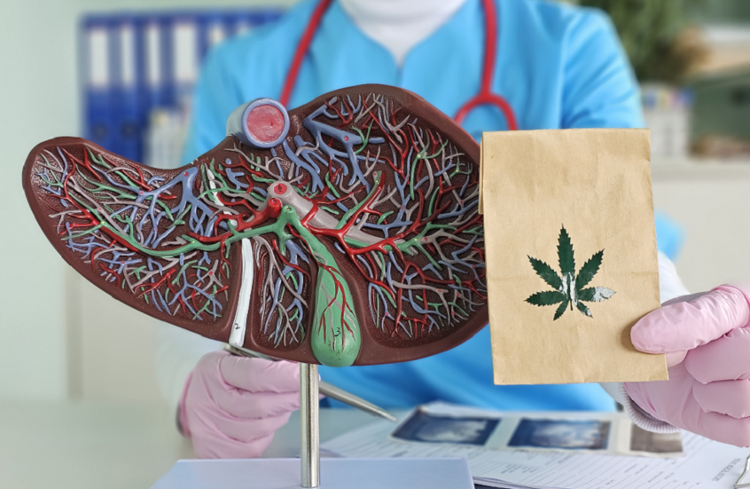 القنب قد يكون مفتاحا لعلاج مرض الكبد الدهني