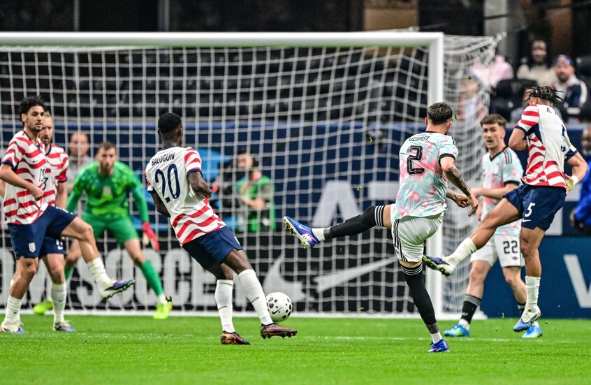 قميص أم فوضى؟.. مباراة ودية تتحول إلى كوميديا لونية