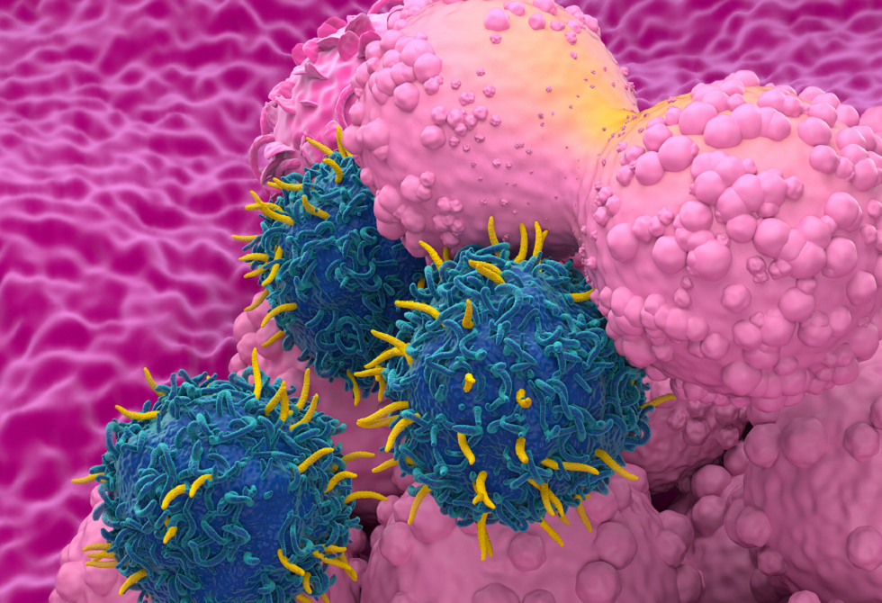 علاج لسرطان الثدي يقي المريضات من أثر جانبي مرهق ومثير للقلق