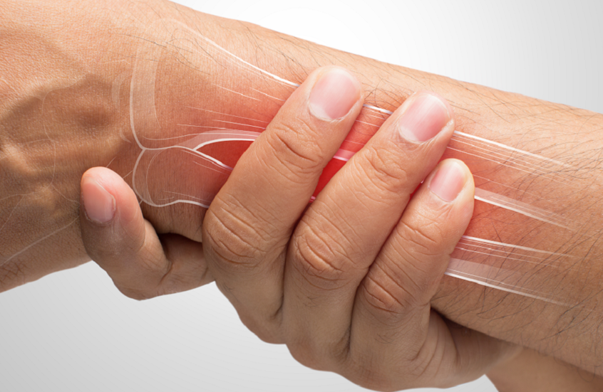 العلاقة بين أمراض القلب وهشاشة العظام لدى النساء بعد انقطاع الطمث