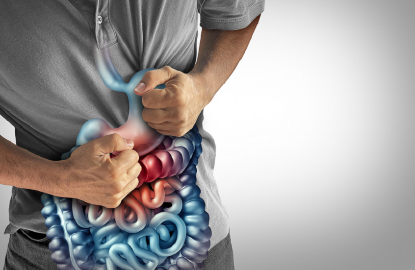 بشرى لمرضى كرون.. اكتشاف قد ينهي المعاناة من أكثر المضاعفات صعوبة في العلاج