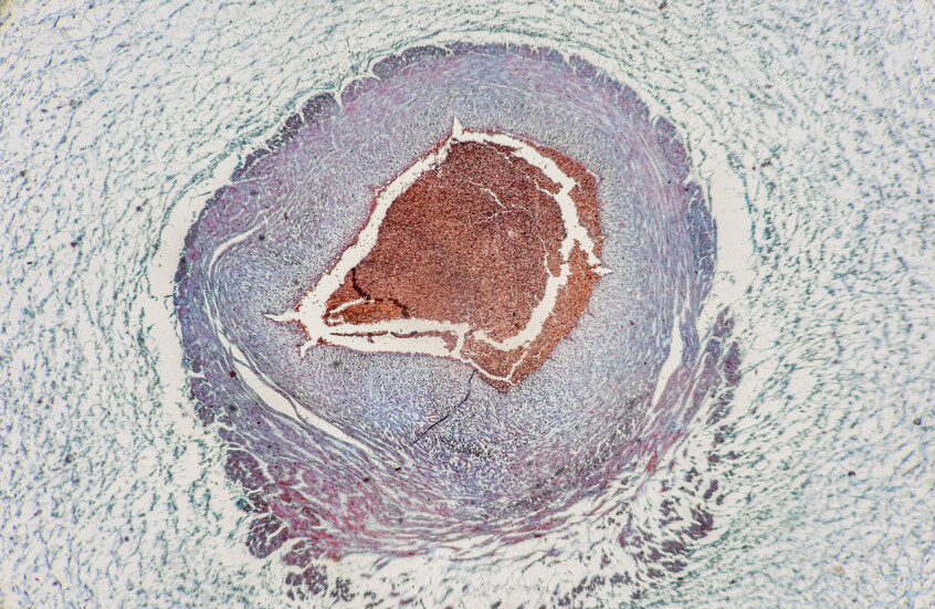 اكتشاف نوع جديد من الخلايا لا يظهر إلا أثناء الحمل!