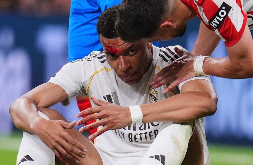 خبير تحكيمي يبدي رأيه حول عدم احتساب ركلة جزاء لمبابي