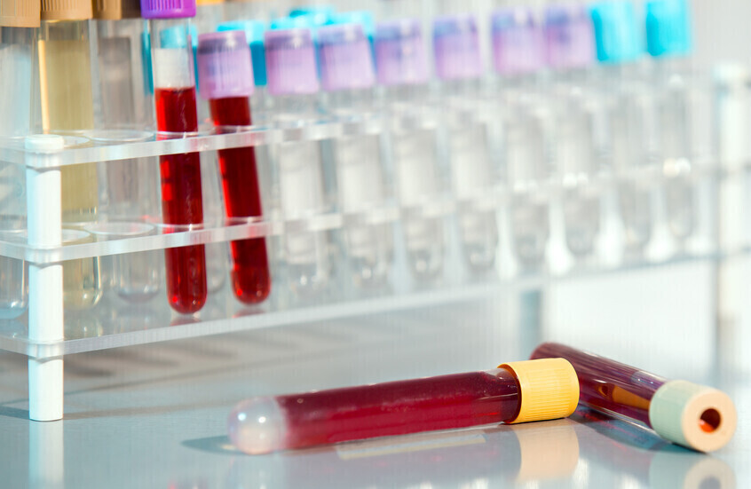 اكتشاف علامة مبكرة خفية للإصابة بالسرطان