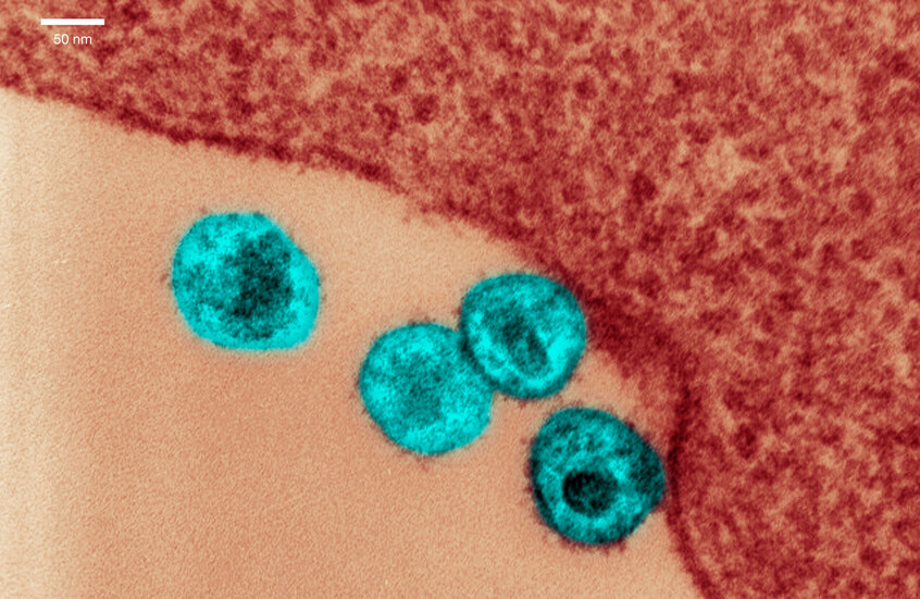 يحملها شقيقه.. طفرة جينية نادرة تنهي معاناة "مريض أوسلو" مع الإيدز والسرطان معا!