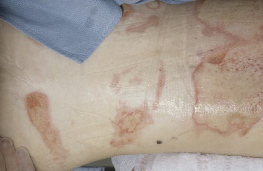 ابتكار روسي قد يشكل طفرة علمية في مجال الطب التجديدي