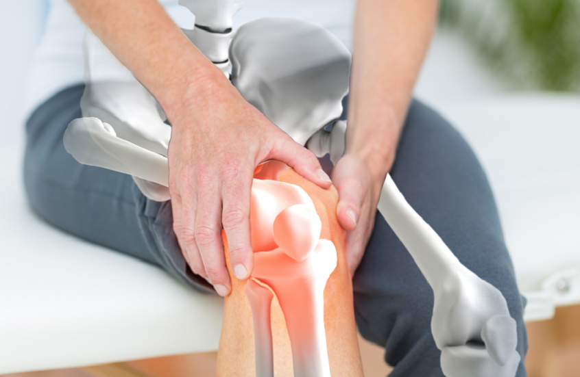 علاج طبيعي لالتهاب المفاصل يتجاوز فعالية الأدوية التقليدية