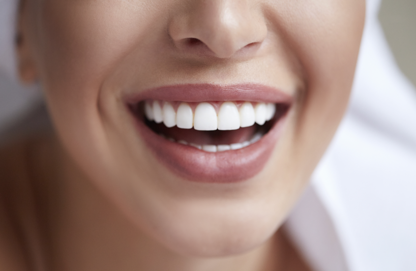 أطعمة بسيطة تعزز بياض الأسنان طبيعيا