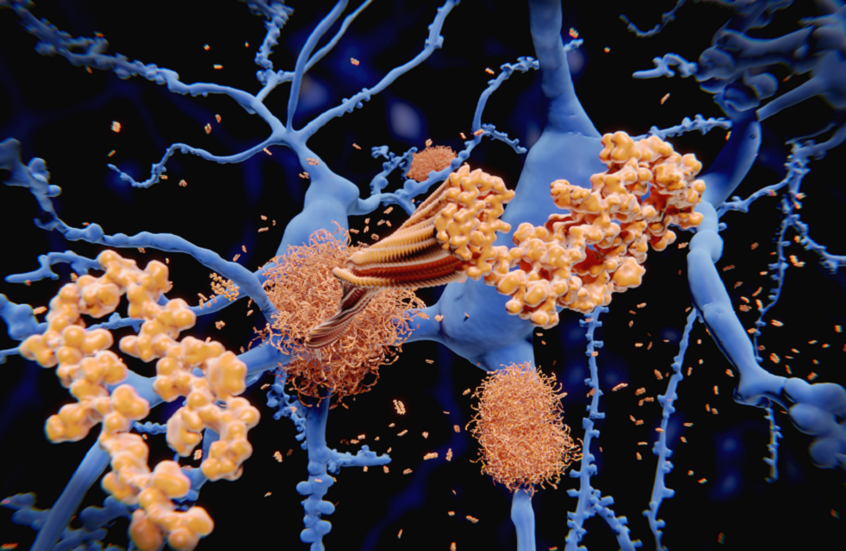 اكتشاف آلية خلوية تمنع تكوّن الألياف المرتبطة بألزهايمر
