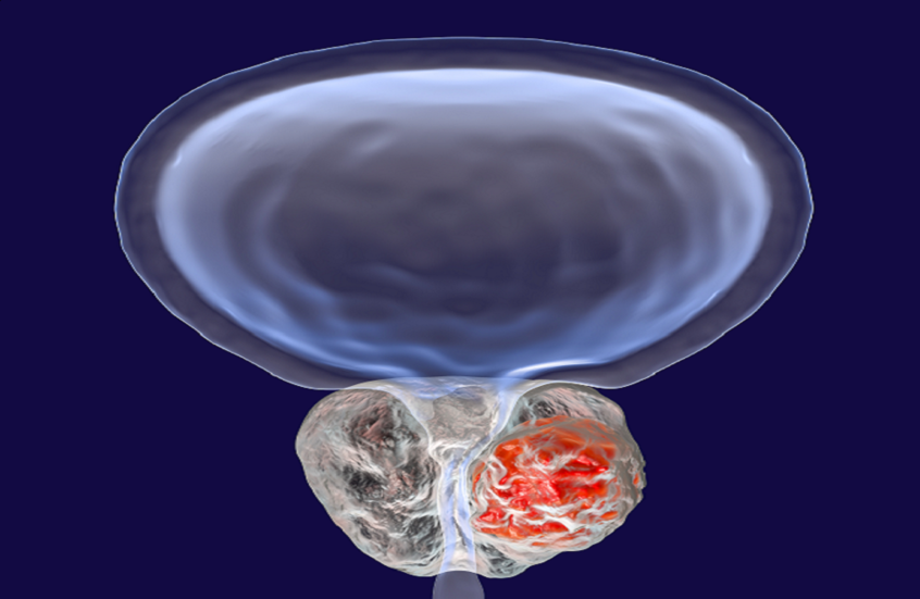 روسيا.. اكتشاف خاصية جديدة لجزيئات الحمض النووي الريبوزي القصيرة المرتبطة بالسرطان