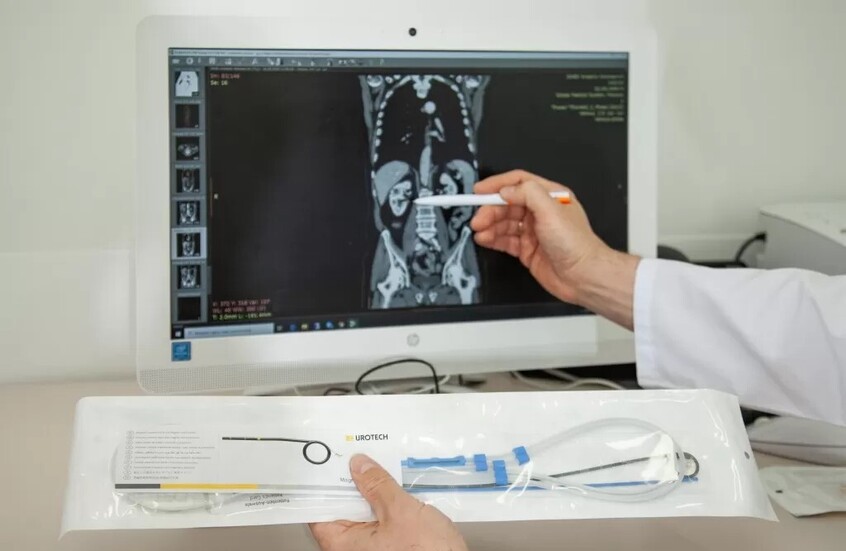 علماء روس يبتكرون طريقة لتشخيص أمراض المسالك البولية باستخدام الهاتف الذكي