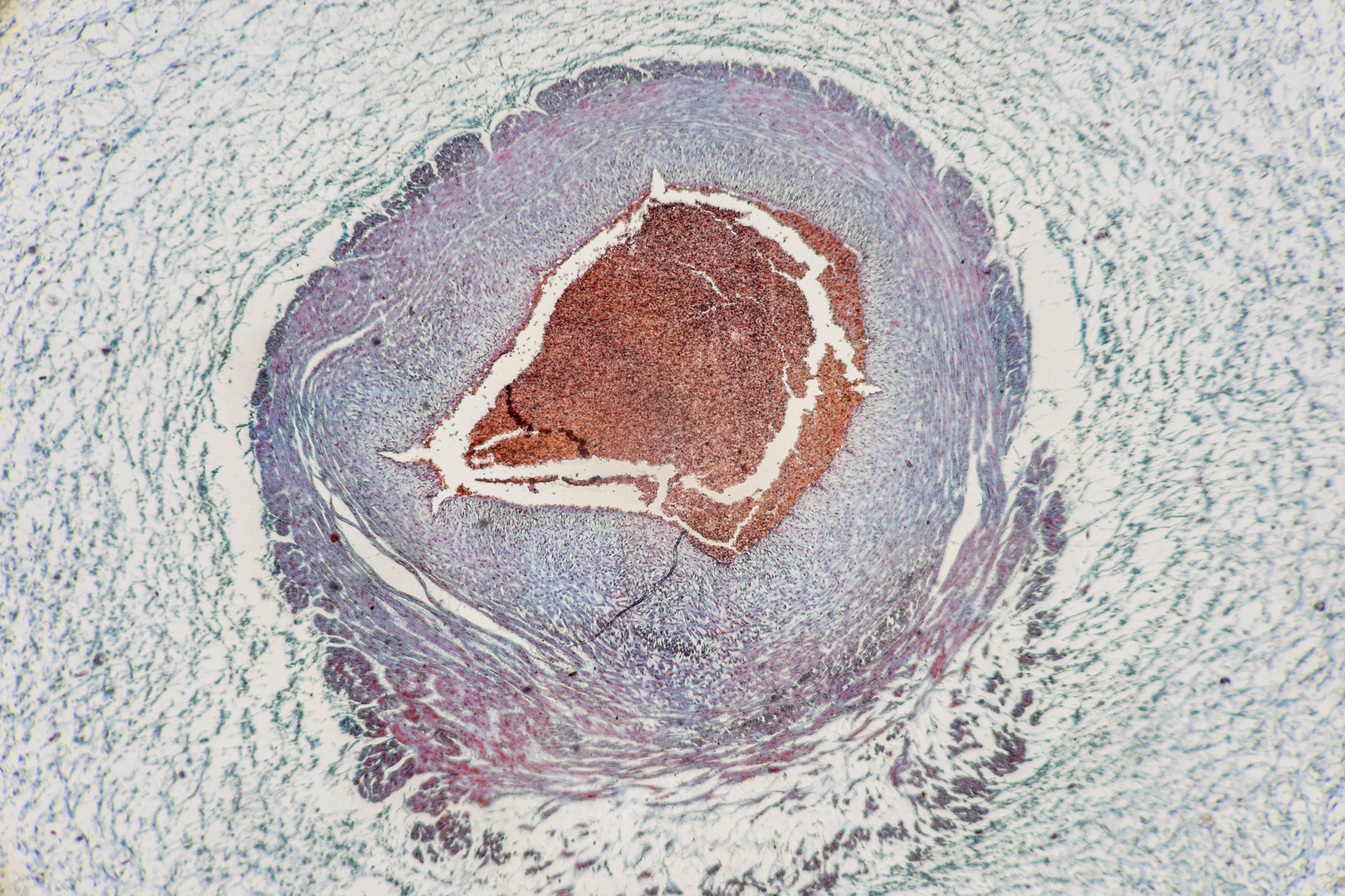 اكتشاف نوع جديد من الخلايا لا يظهر إلا أثناء الحمل!