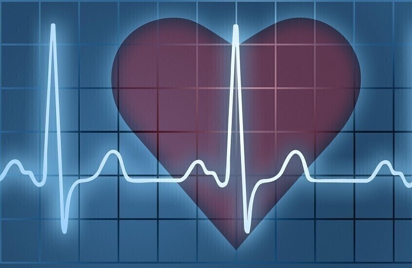 ما هي معدلات نبض القلب الخطيرة المهددة بالسكتة الدماغية؟