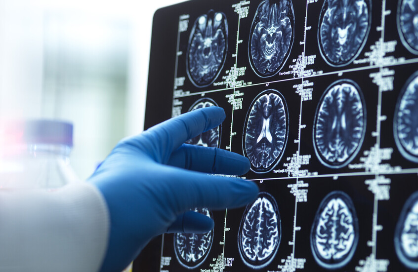 لعبة ذهنية بسيطة قد تقلل خطر الخرف بنسبة 25%