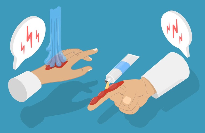 العلماء الروس يطورون مواد جديدة تسرّع التئام الحروق