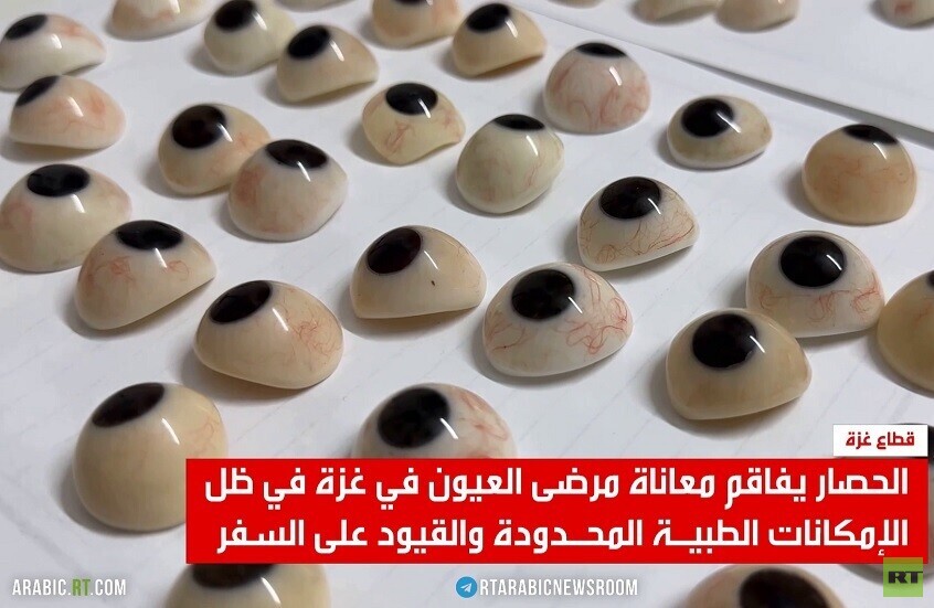 الحصار يفاقم معاناة مرضى العيون في غزة