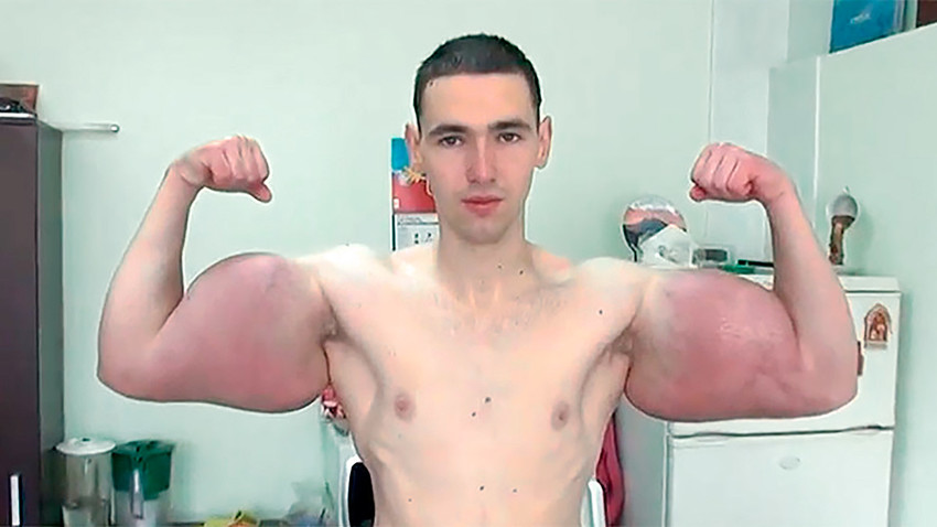 Looks to die for: Why this Russian 'bodybuilder' could lose his hands -  Russia Beyond