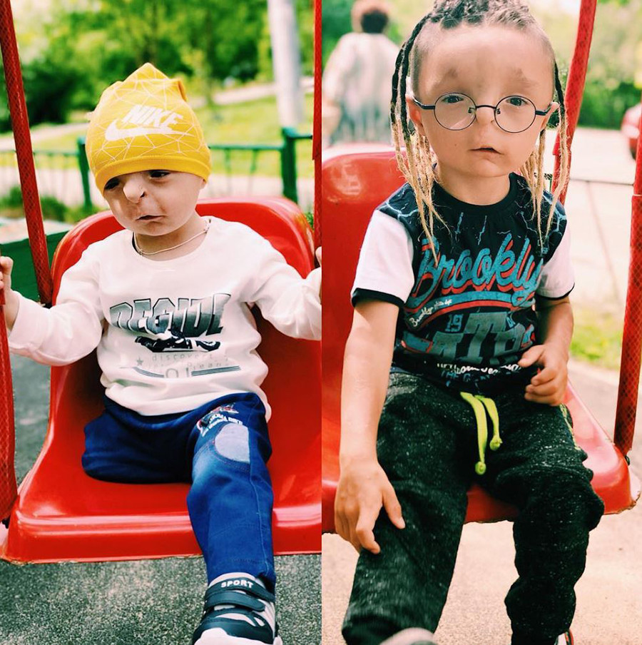 Antes e depois: Rustam quando foi adotado e depois de um ano na família de Nika.
