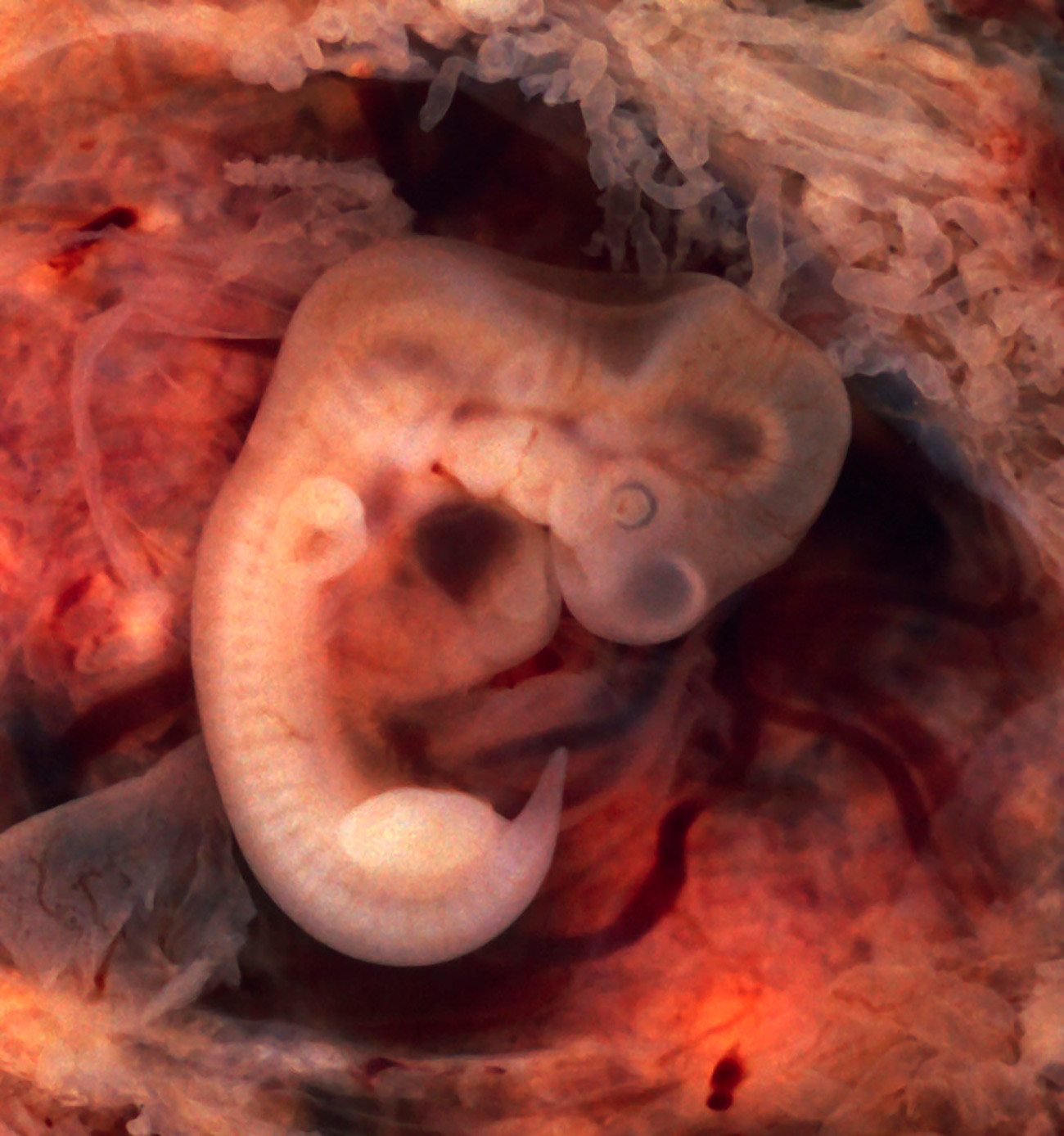 Ембрион човека крајем четврте недеље трудноће.