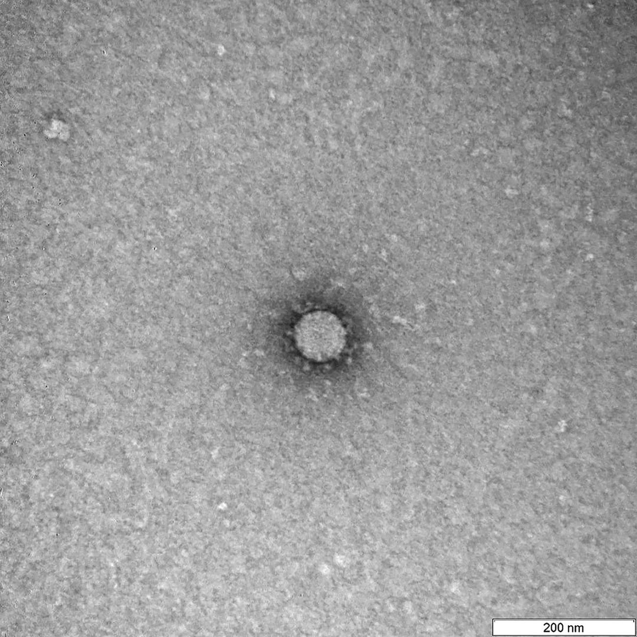 Снимки на вирусот COVID-19 направени преку микроскоп во Државниот научен центар за вирусологија и биотехнологија „Вектор“