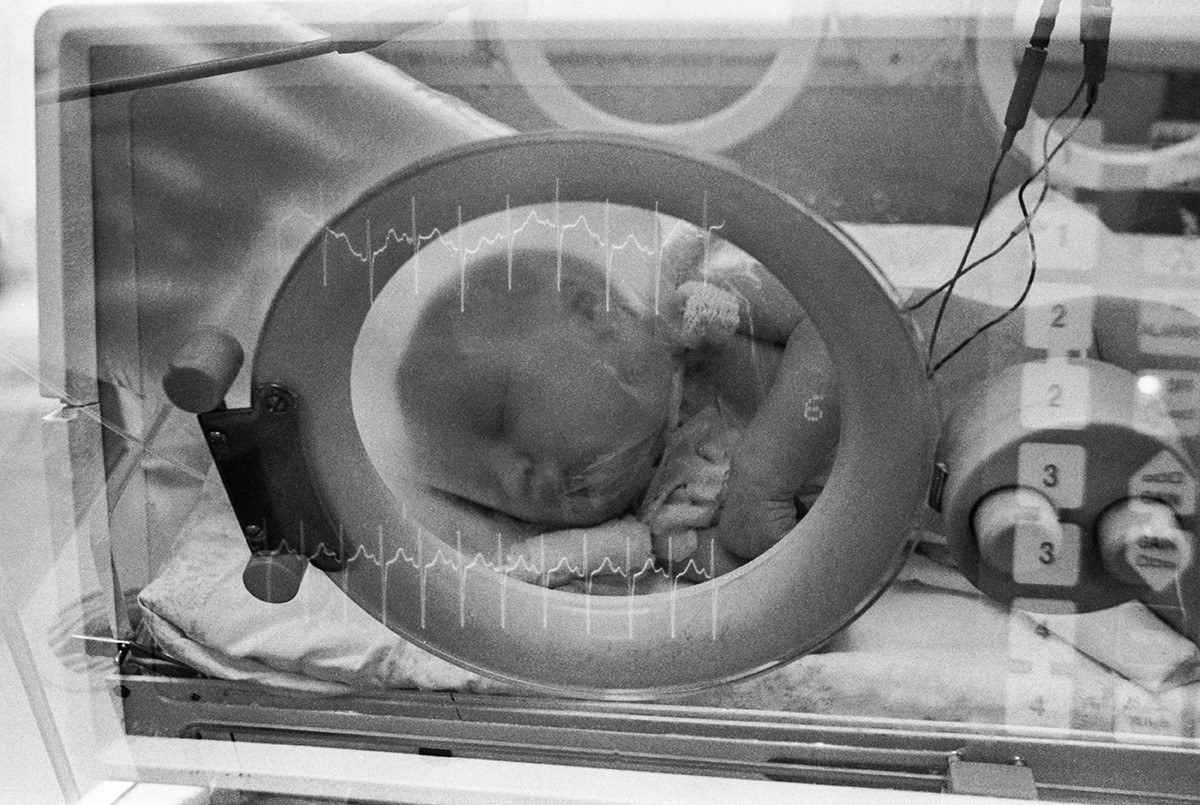 April 1, 1989 A newborn in a medical incubator. 