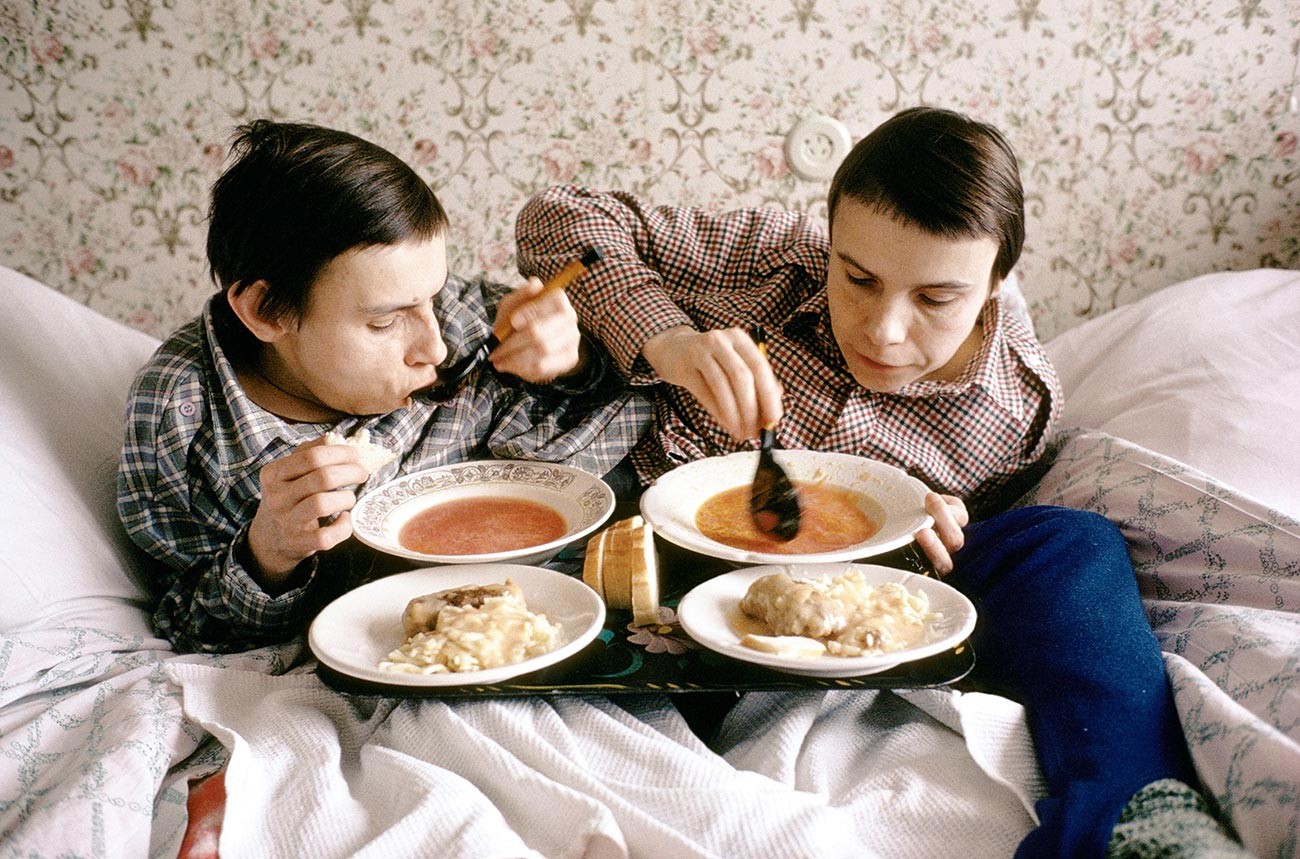 Руските сиамски близначки Маша и Даша Кривошляпови в Москва