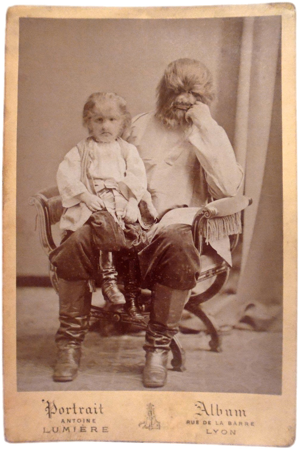 Адриан Евтихиев със сина си Фьодор Евтихиев, известен също като Jo-Jo, момчето с кучешката глава. Клод-Антоан Люмиер