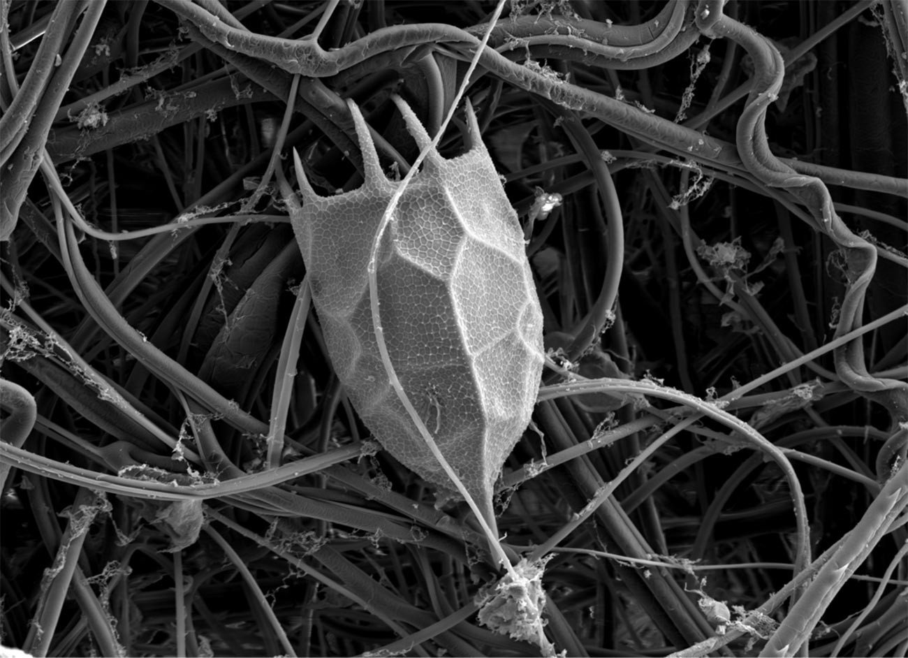 Bagian locula rotifera Keratella cochlearis, pemindaian gambar dengan mikroskop elektron.
