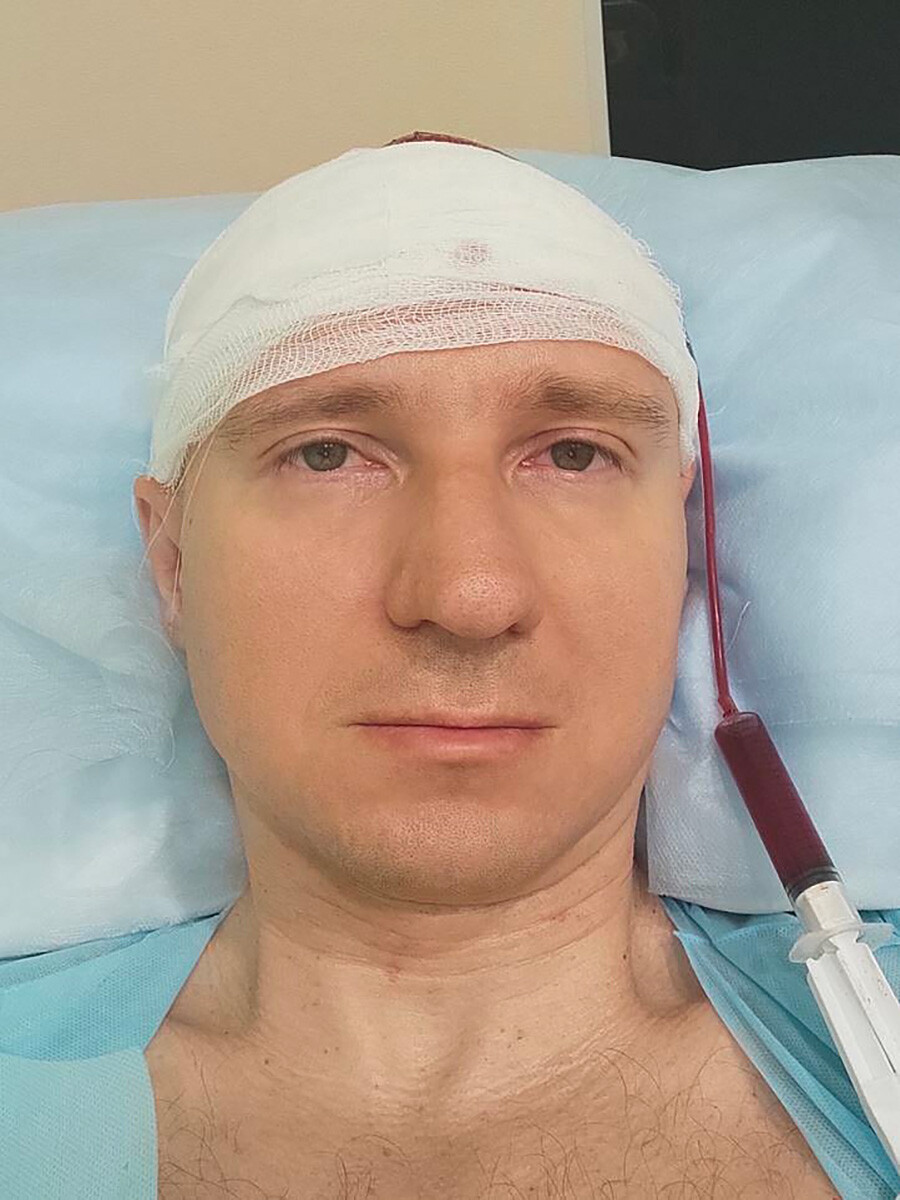 Mikhail in the hospital, after the electrodes were removed. A blood drainage pipe is connected to the wound in his head.