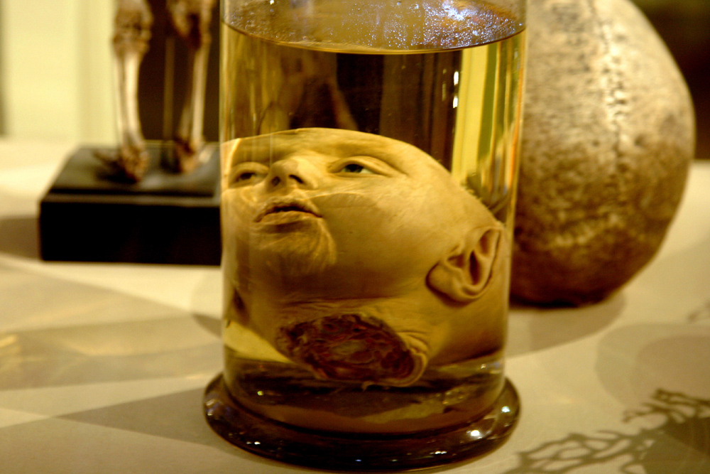 Some of the most fascinating of the millions of exhibits are to be found in the collection of Dutch anatomist Frederik Ruysch, who spent 50 years collecting "wet" (preserved in ethanol) specimens of infants, including many prepared heads, and human body parts.