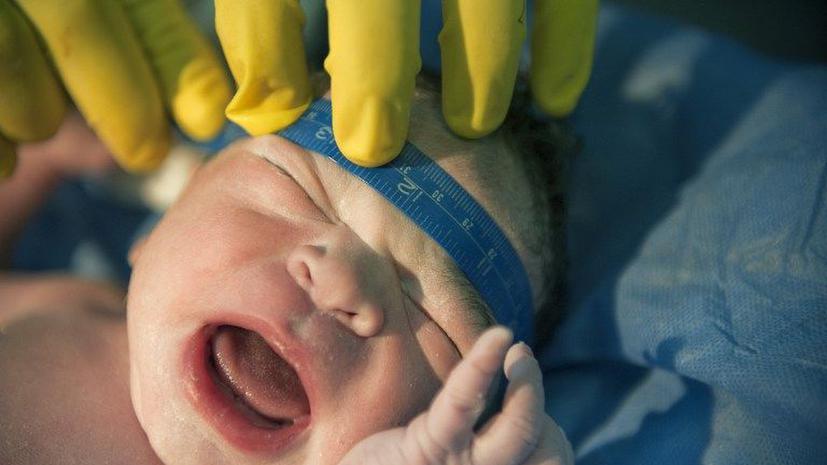 Британские врачи заморозили младенца, чтобы спасти его жизнь