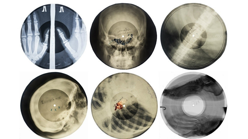 Музыка на костях: как записывали музыку на рентгеновские снимки – poch-internat.ru