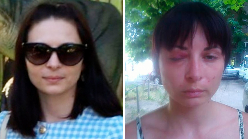 МВД Украины признало факт пыток обвиняемой в госизмене Дарьи Мастикашевой