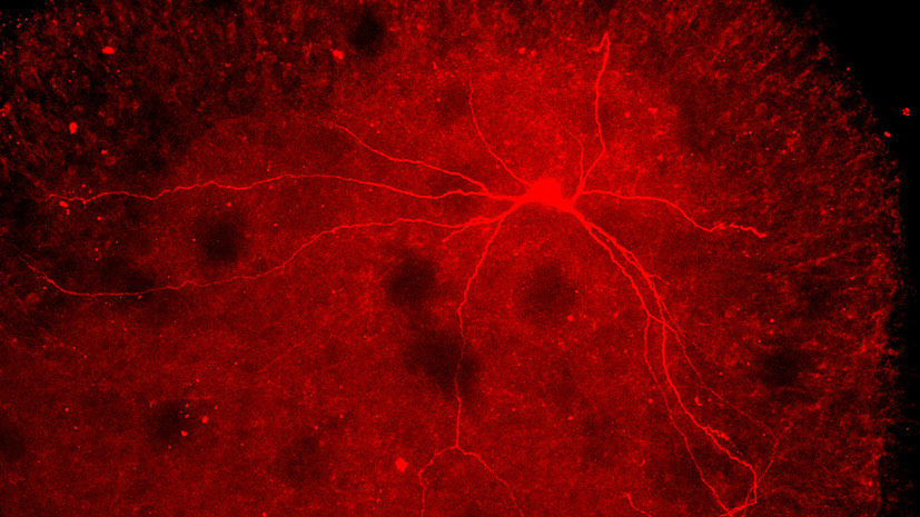 «Вылечить Стивена Хокинга»: помогут ли новые данные о двигательных нейронах справиться с неизлечимым недугом