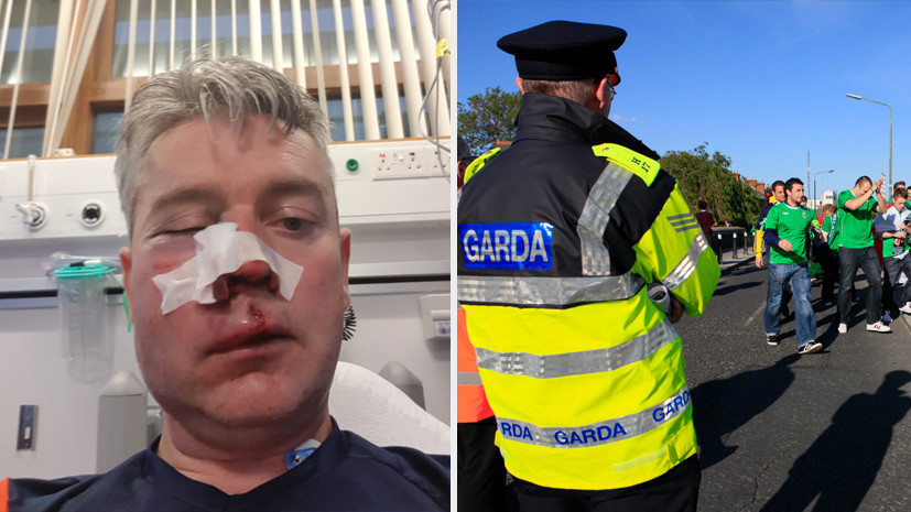 «Не может ни есть, ни говорить»: в Ирландии трое футболистов подозреваются в избиении арбитра