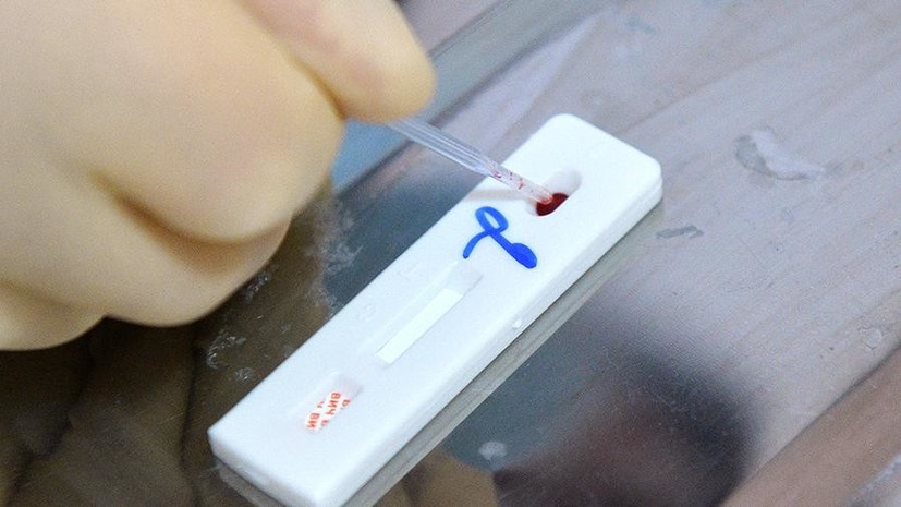 В Новосибирске запустили ночные добровольные проверки на ВИЧ и гепатит