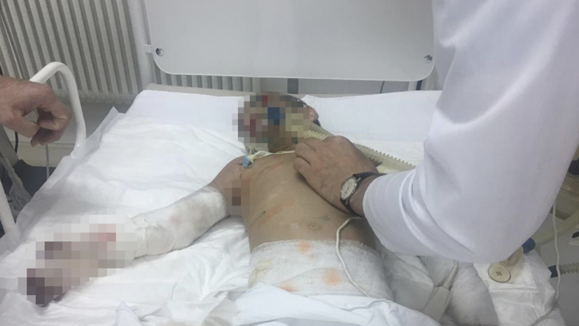 Избитой девочке из Ингушетии ампутировали часть правой руки