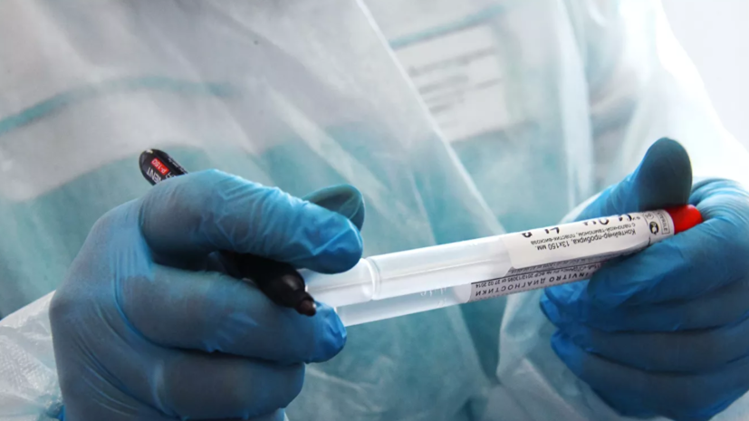 В Новосибирской области выявили два новых случая коронавируса