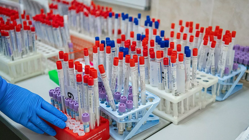 В России зарегистрировано 11 тест-систем для диагностики коронавируса