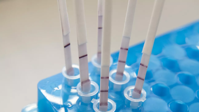 В Ростовской области рассказали о возрасте новых заболевших COVID-19