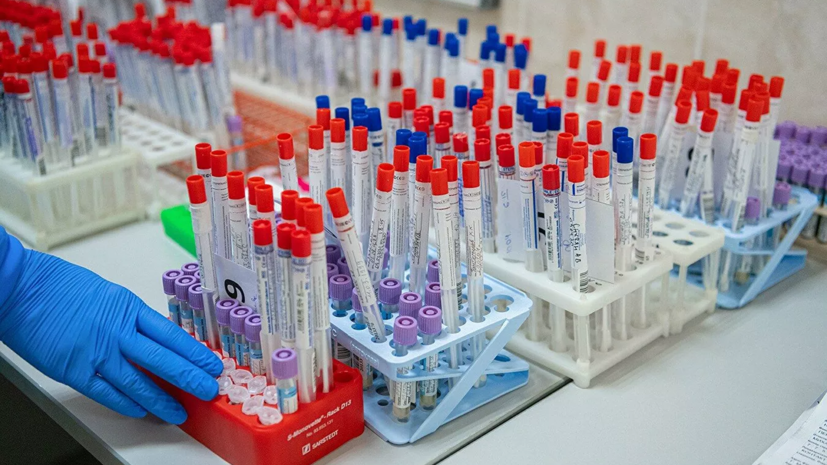 Медсестра из краснодарской больницы рассказала о работе по борьбе с COVID-19