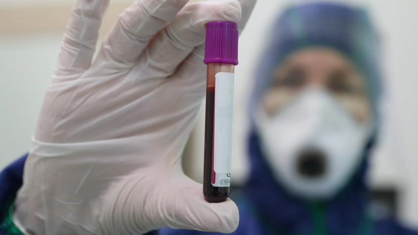 Гастроэнтеролог оценил сообщения о новом клиническом проявлении коронавируса