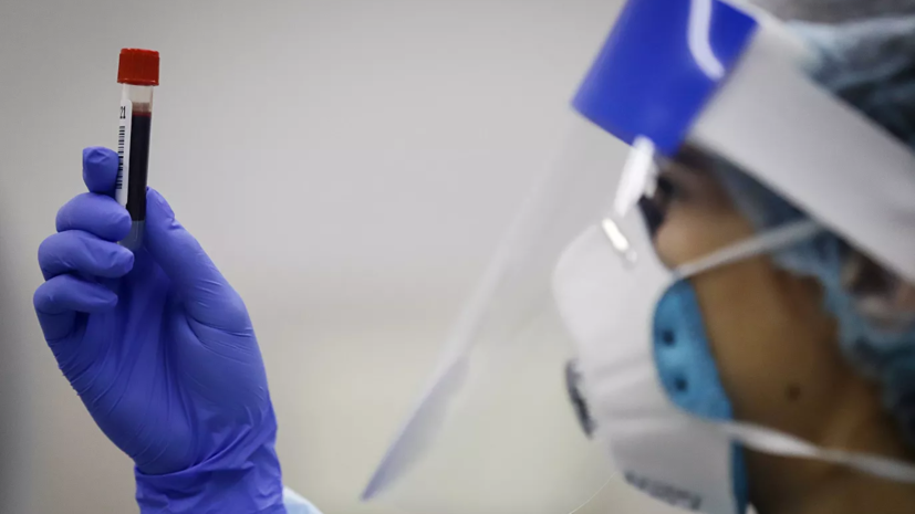 Тренер вратарей «Оренбурга» Захарчук сдал положительный тест на коронавирус