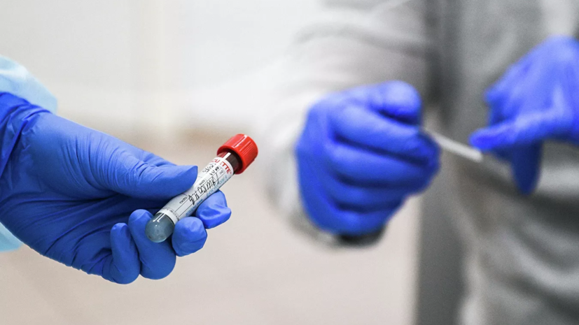 Москвичи могут с 27 мая пройти тест на наличие антител к коронавирусу