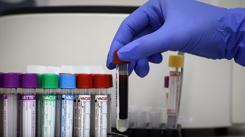 Число случаев коронавируса в Сербии превысило 24 тысячи