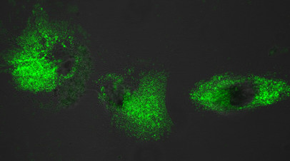 Культура фибробластов человека, обработанная синтезированным соединением. Зелёным подсвечиваются ионы кальция внутри клеток, чёрные области внутри — клеточные ядра