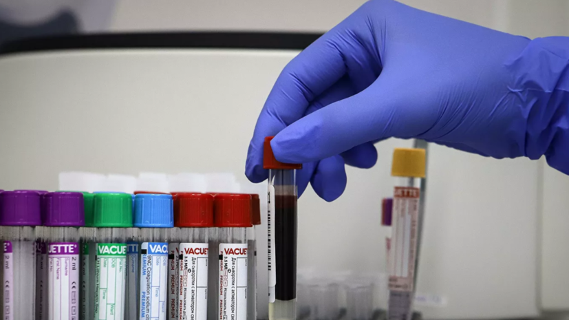 В Петербурге за сутки более 8 тысяч человек сдали тест на COVID-19